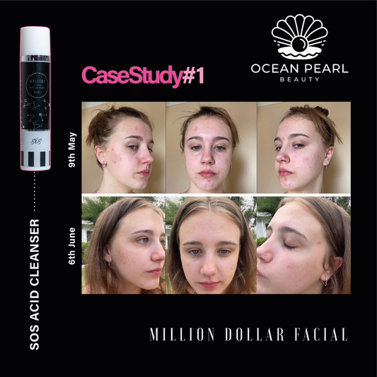 Chronic Stress & Skin Ageing: What Every Modern Facialist (and Client) Needs to Know