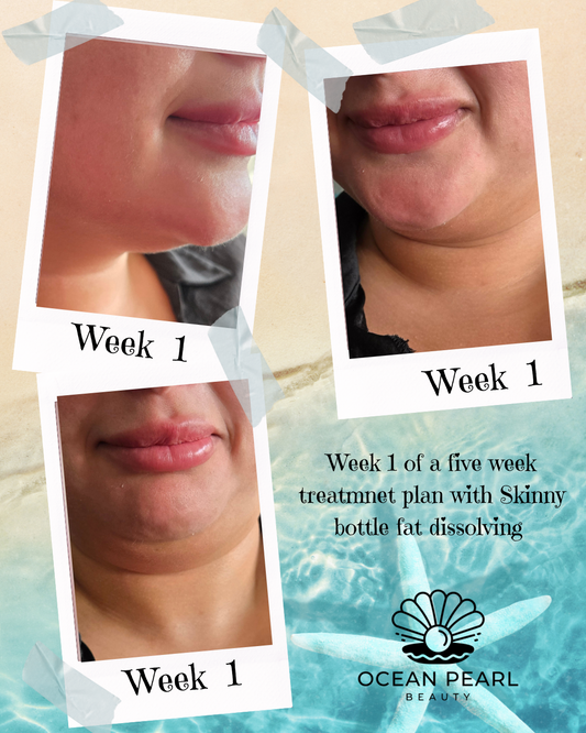 The Body Confidence Package – Target Stubborn Areas Properly